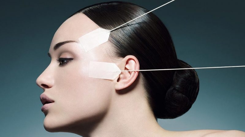 A Thread Lift Procedure Can Make You Look Younger