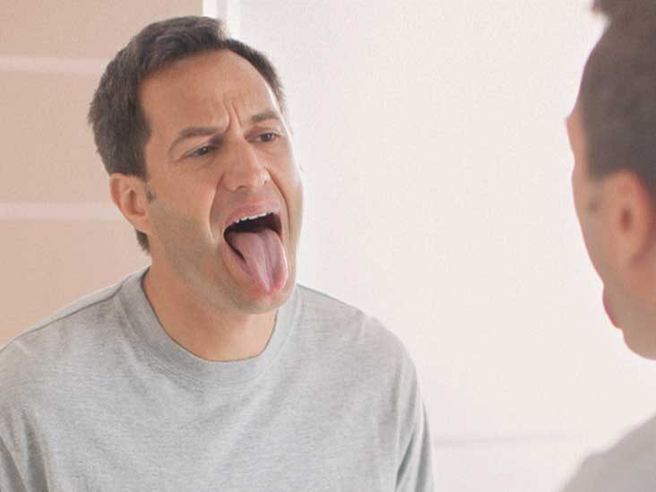 Is Your Tongue a Clue to Oral Health?