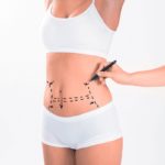 Facts That You Should Know About Liposuction Fibrosis Treatment