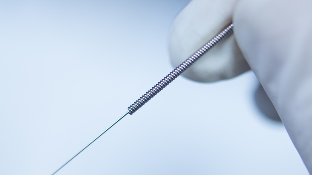 Needling Treatment