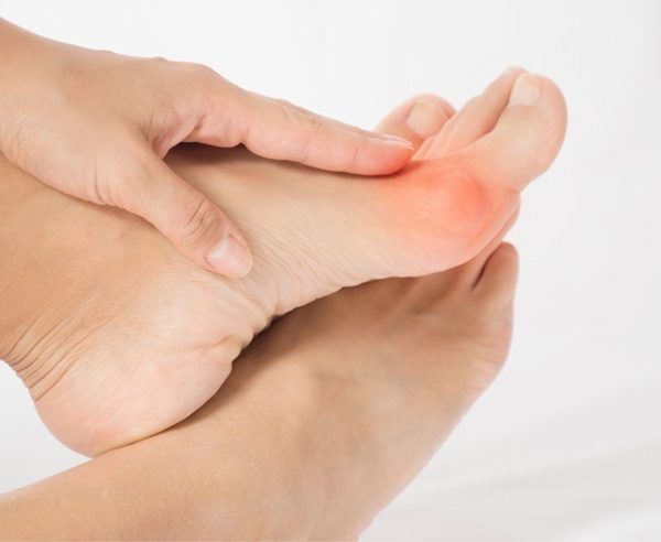 Bunions Affect Your Overall Health