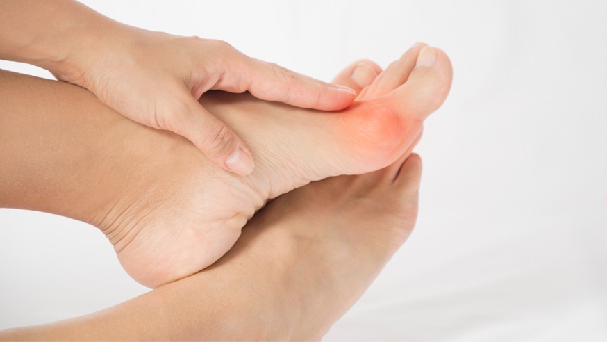Bunions Affect Your Overall Health