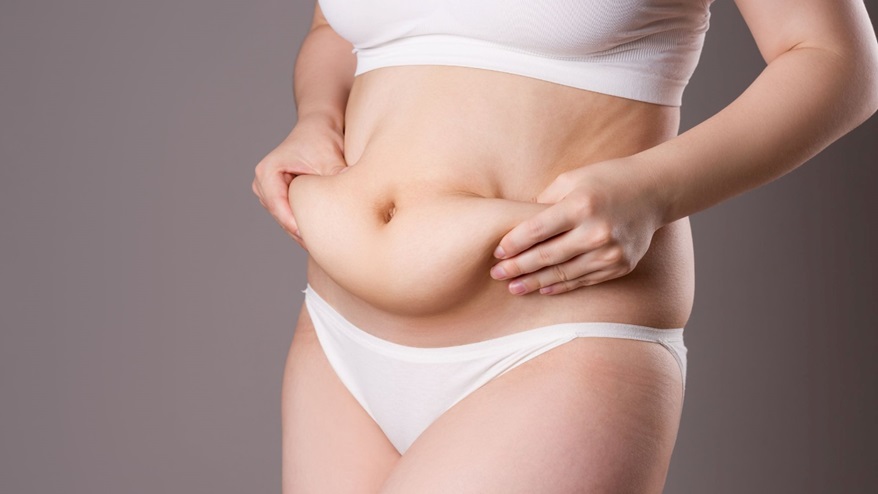 Tummy Tuck