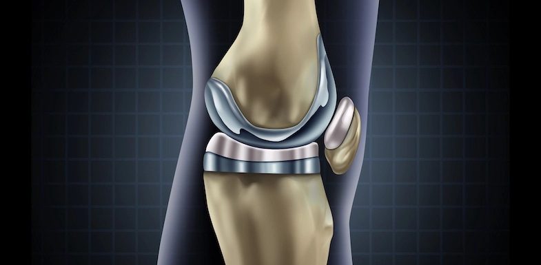 Does Knee Pain Go Away After Surgery?