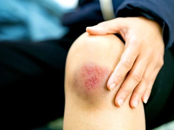 6 Best Vascular Care Options for Severely Damaged Blood Vessels