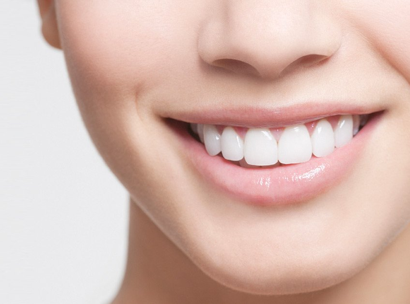 Smile Better with These 5 Custom Dental Treatments