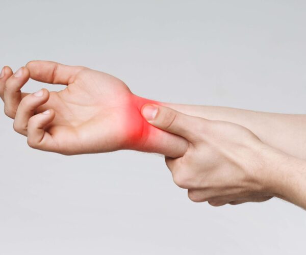 6 Home Treatments for Carpal Tunnel Syndrome