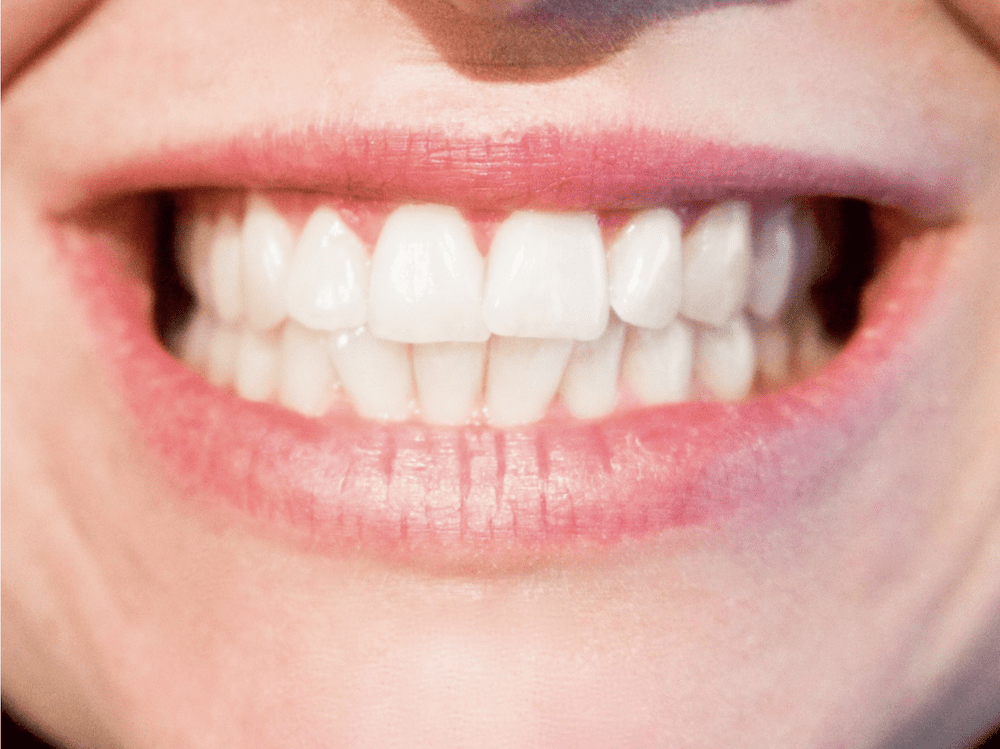 Dental Warning Signs You Should Never Ignore