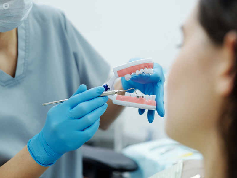 Why You Might Need an Orthodontist