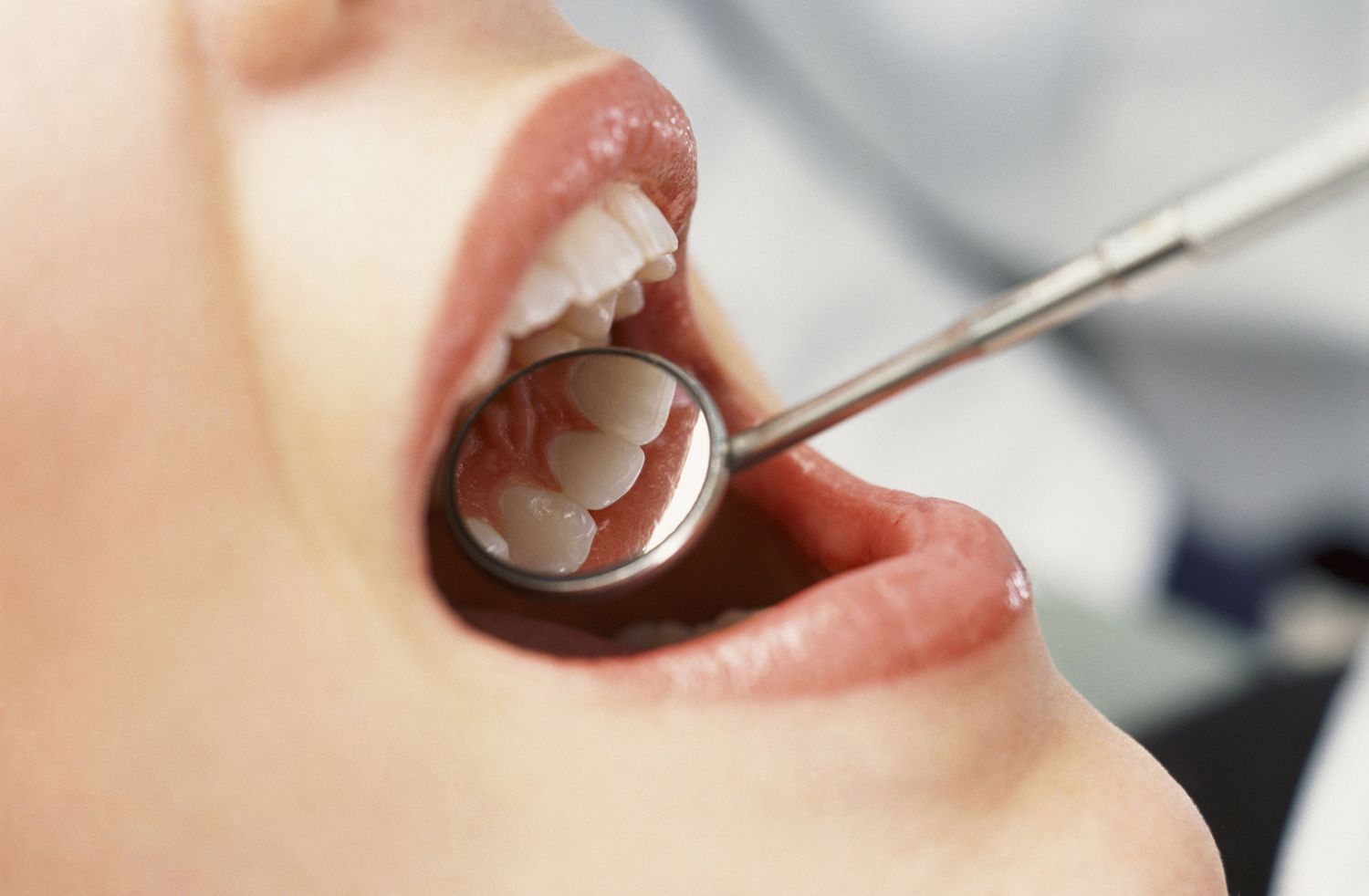 Finding the Right Solutions to Oral Health Issues