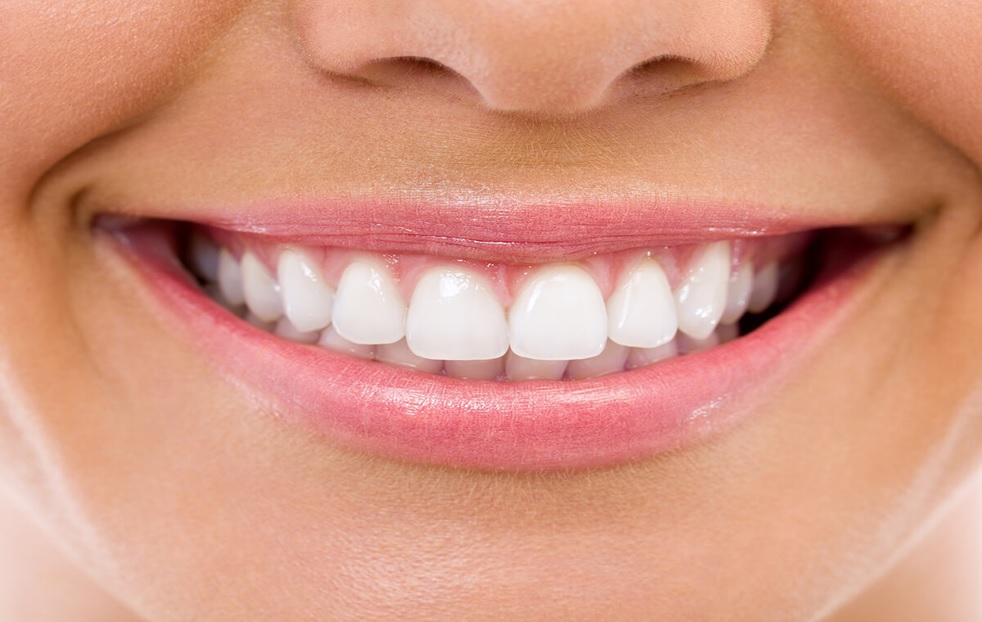 Straightforward Preparation Tips for Getting Dental Veneers