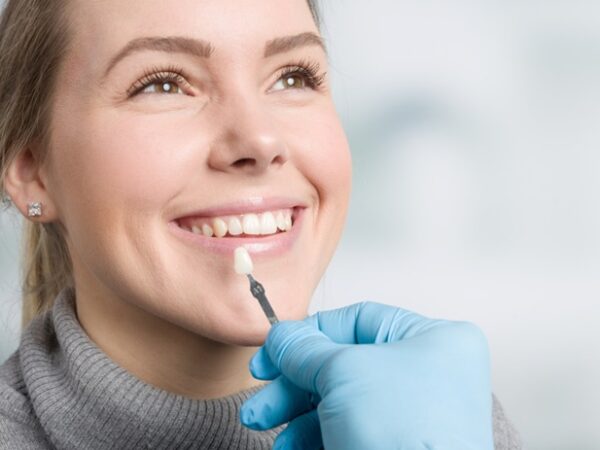 Who Are Good Candidates for Dental Veneers?