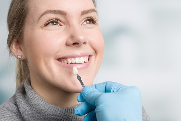 Who Are Good Candidates for Dental Veneers?