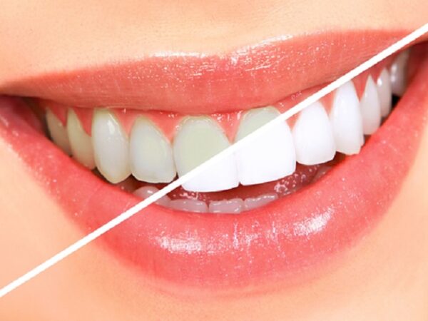 Improve your smile with your cosmetic dentist Sydney