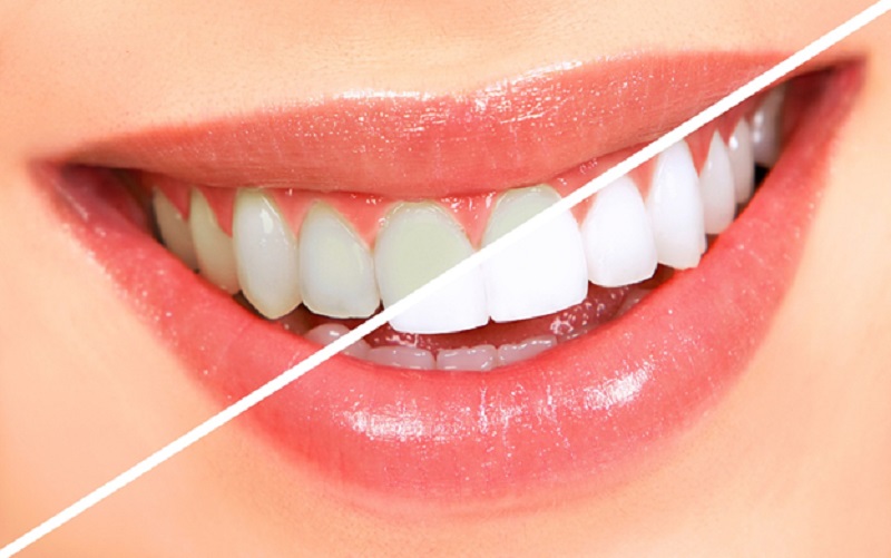Improve your smile with your cosmetic dentist Sydney