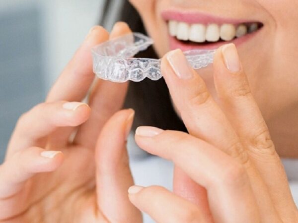 Aligners versus braces: which is better?