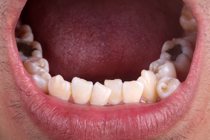 Lighten up your smile with orthodontic treatment: unexpected perks of teeth straightening you should know about!