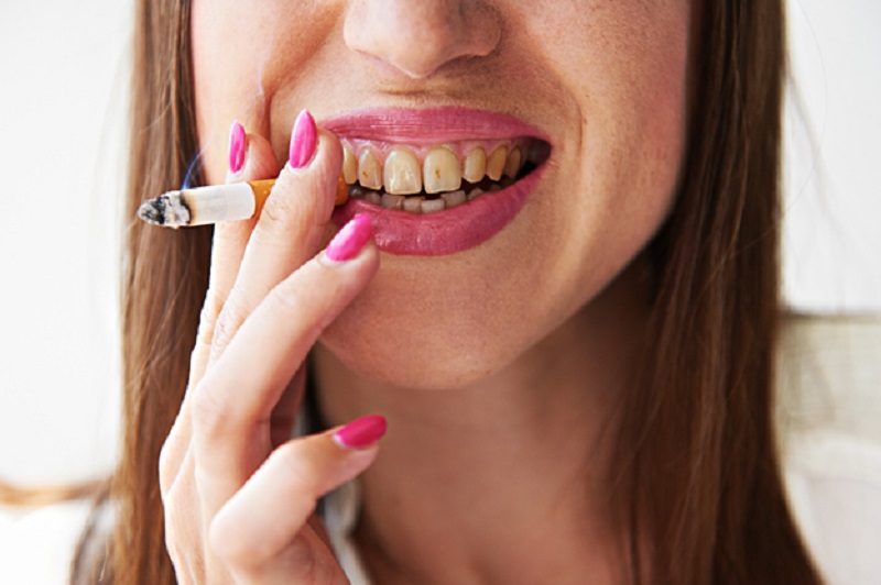 How your dentist in Liverpool can treat periodontitis