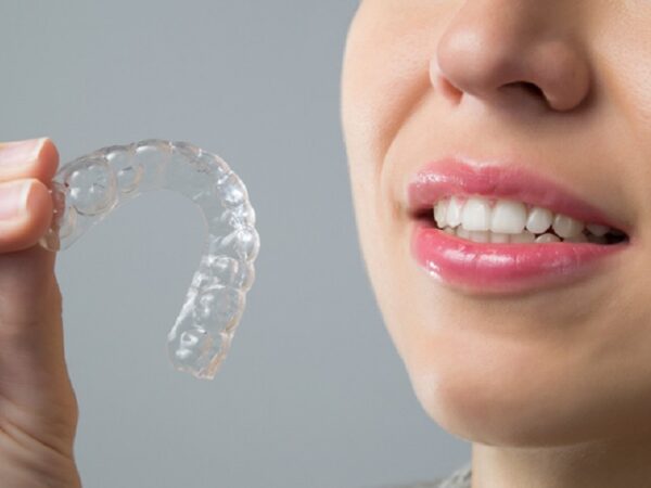 Perfecting your smile with clear aligners: 10 essential points every patient should know
