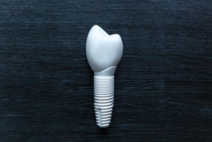 Familiarity with Non-metallic Implant Implantation