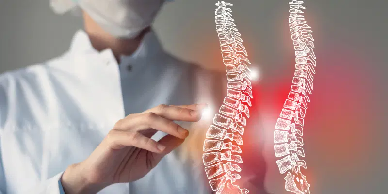 What is Spinal Stenosis? And How is it Treated?